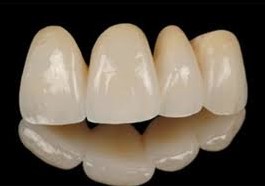 Безметалловые и циркониевые коронки на зубы в Гомеле